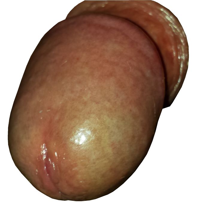 Head