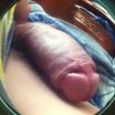 Dick